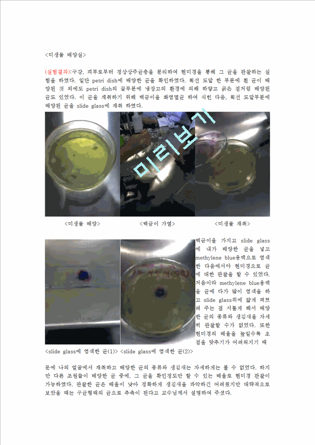 (미생물학실험)미생물 배양실험및 피부미생물종류에 관해서 Report   (1 )